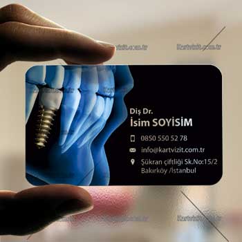 İmplant Şeffaf kartvizit